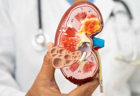 New Approaches to Kidney Care and Patient Outcomes