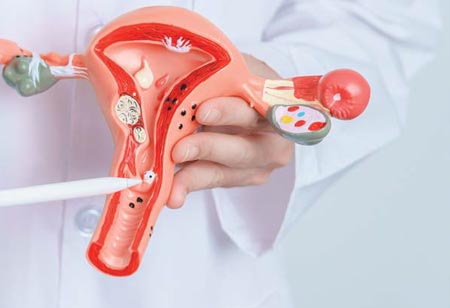 The Rosy App's Success in Cervical Cancer Education